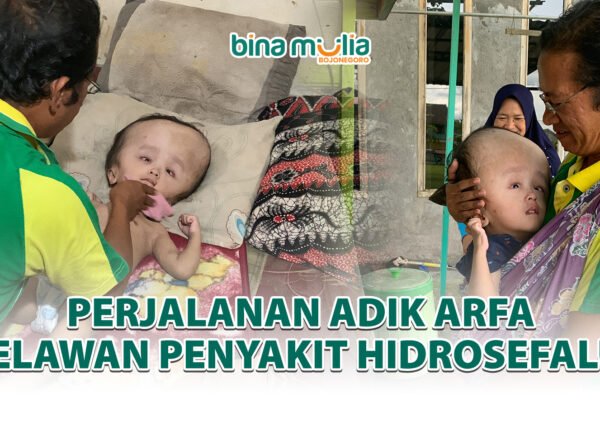 Harapan yang Tak Pernah Padam: Perjalanan Adik Arfa Melawan Penyakit Hidrosefalus